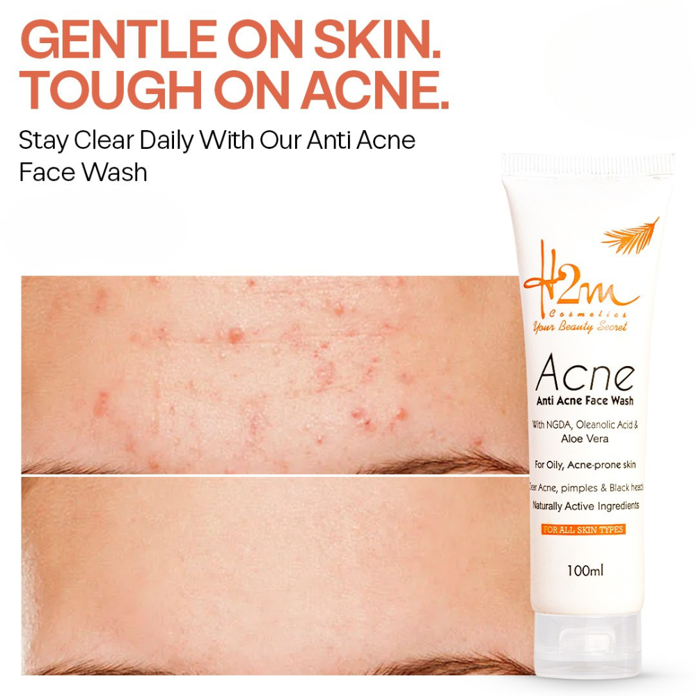 H2M Anti-Acne Face Wash
