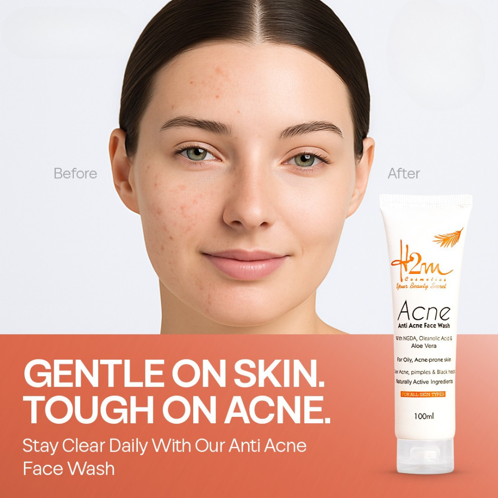 H2M Anti-Acne Face Wash